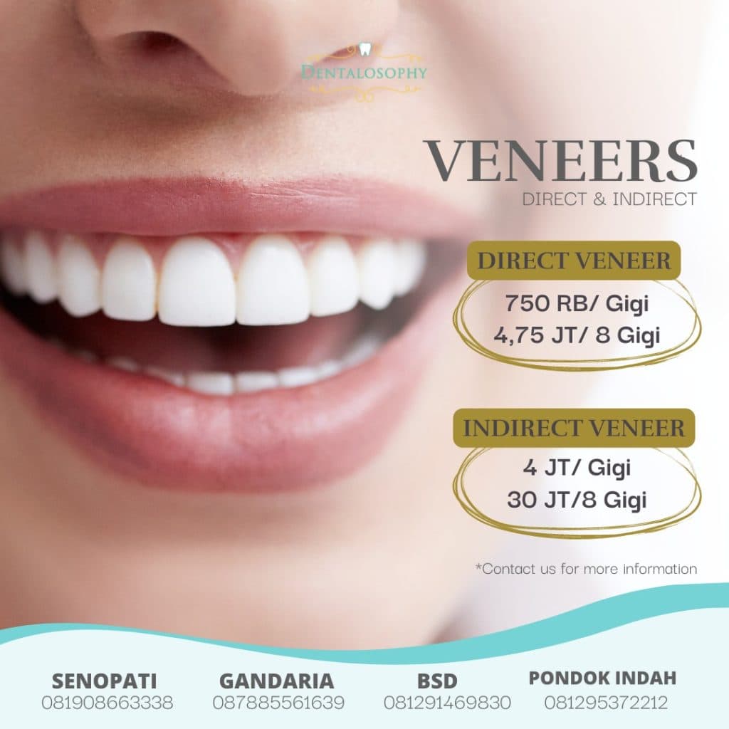 Promo Veneer Gigi